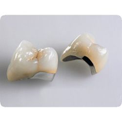 Sứ kim loại Titan