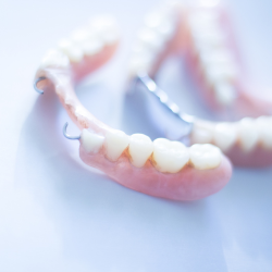 Phục hình tháo lắp hàm khung kim loại