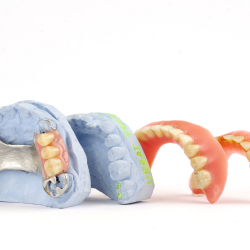 Phục hình tháo lắp nhựa, nên hàm nhựa dẻo