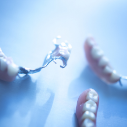 Phục hình hàm khung, hàm tháo lắp