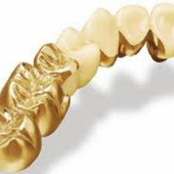 Phục hình cố định kim loại quý, bán quý