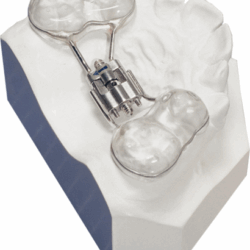 Khí cụ chỉnh nha cố định