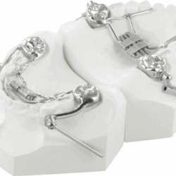 Khí cụ chỉnh nha cố định 4