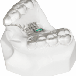 Khí cụ chỉnh nha cố định 5