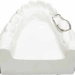 Khí cụ chỉnh nha cố định 6