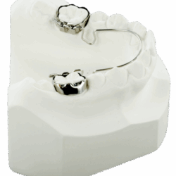 Khí cụ chỉnh nha cố định 7