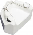 Khí cụ chỉnh nha cố định