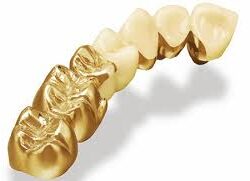 Phục hình cố định kim loại quý 6