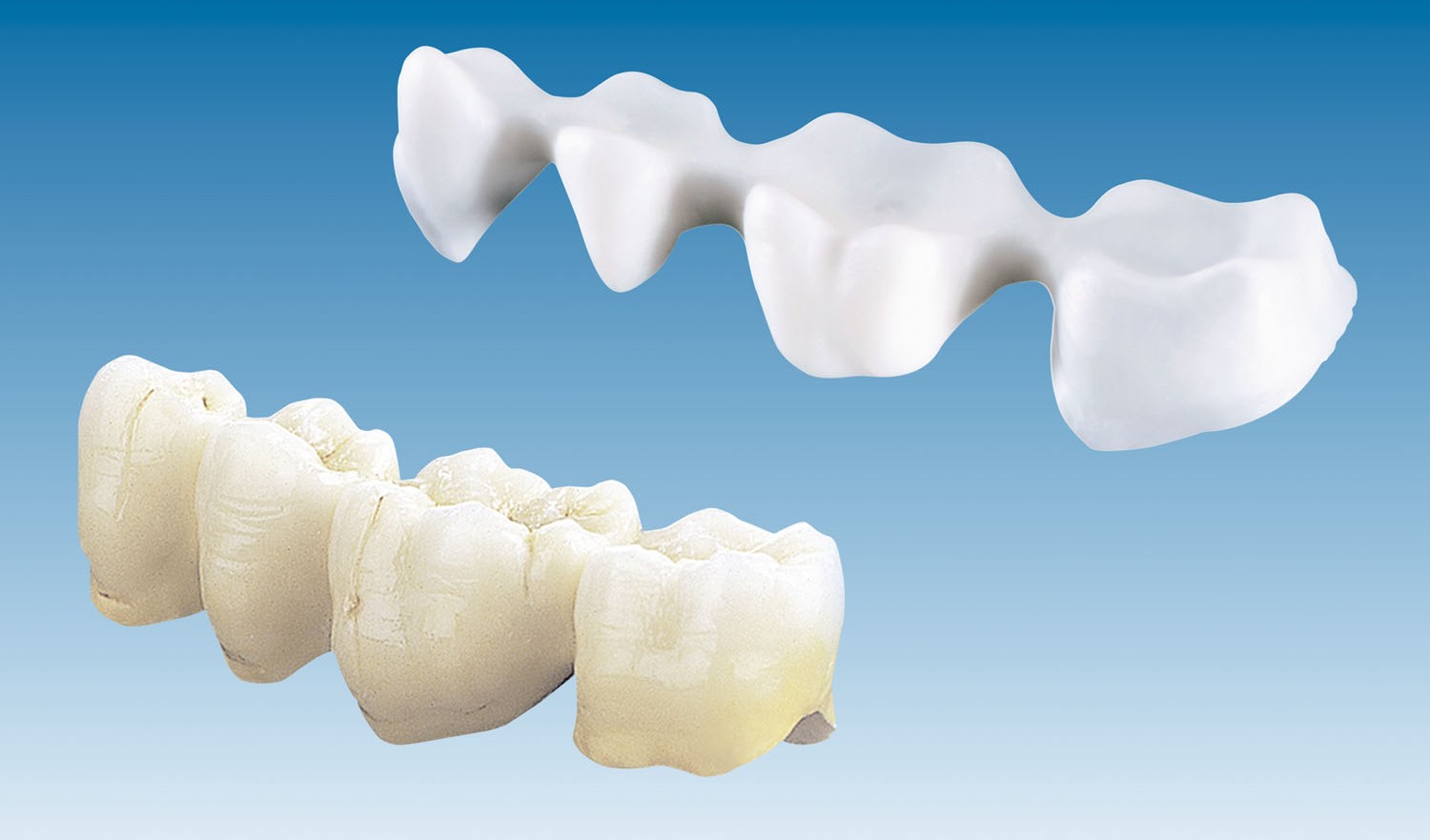 Phục hình sứ không kim loại 02