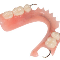 Phục hình tháo lắp nhựa cứng (2)