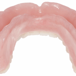 Phục hình tháo lắp nhựa dẻo