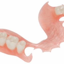 Phục hình tháo lắp nhựa dẻo (3)