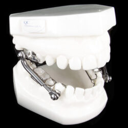 The Banded Cantilever Herbst®